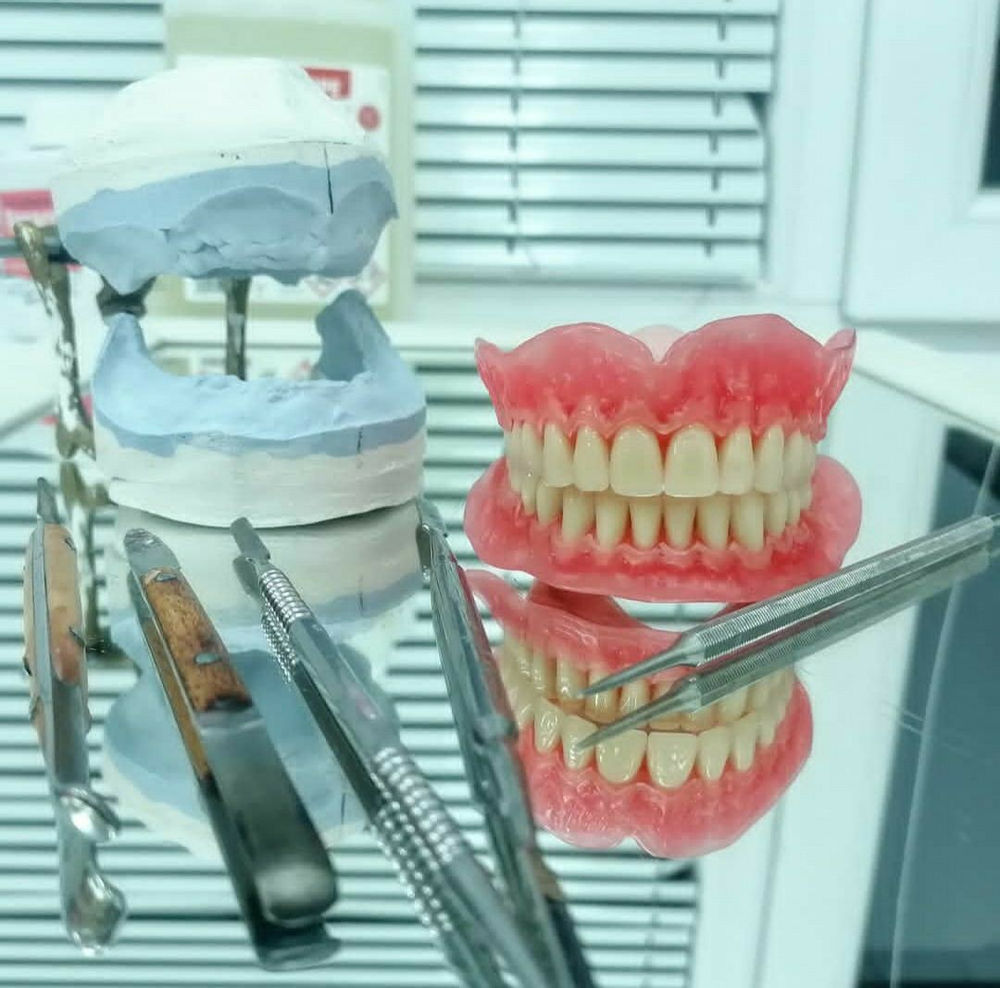 ساخت دندان های متحرک ساخت و تعمیر انواع دندانهای متحرک